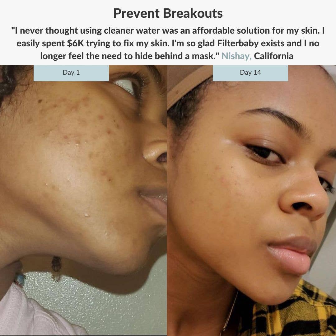 Advanced Water Filter with PRODermis® Water Softener